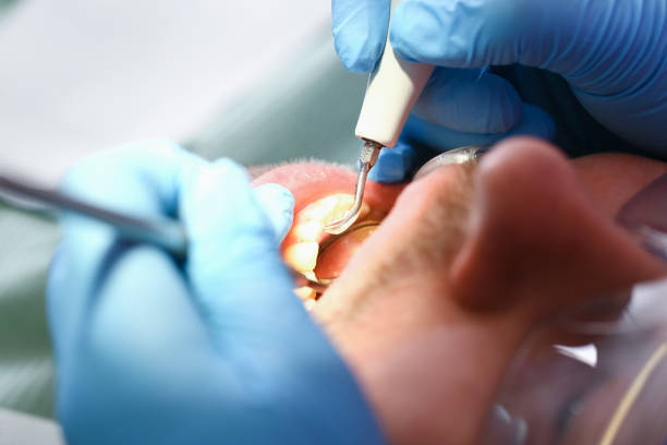 Best Walk-In Emergency Dentist in Winona, MS